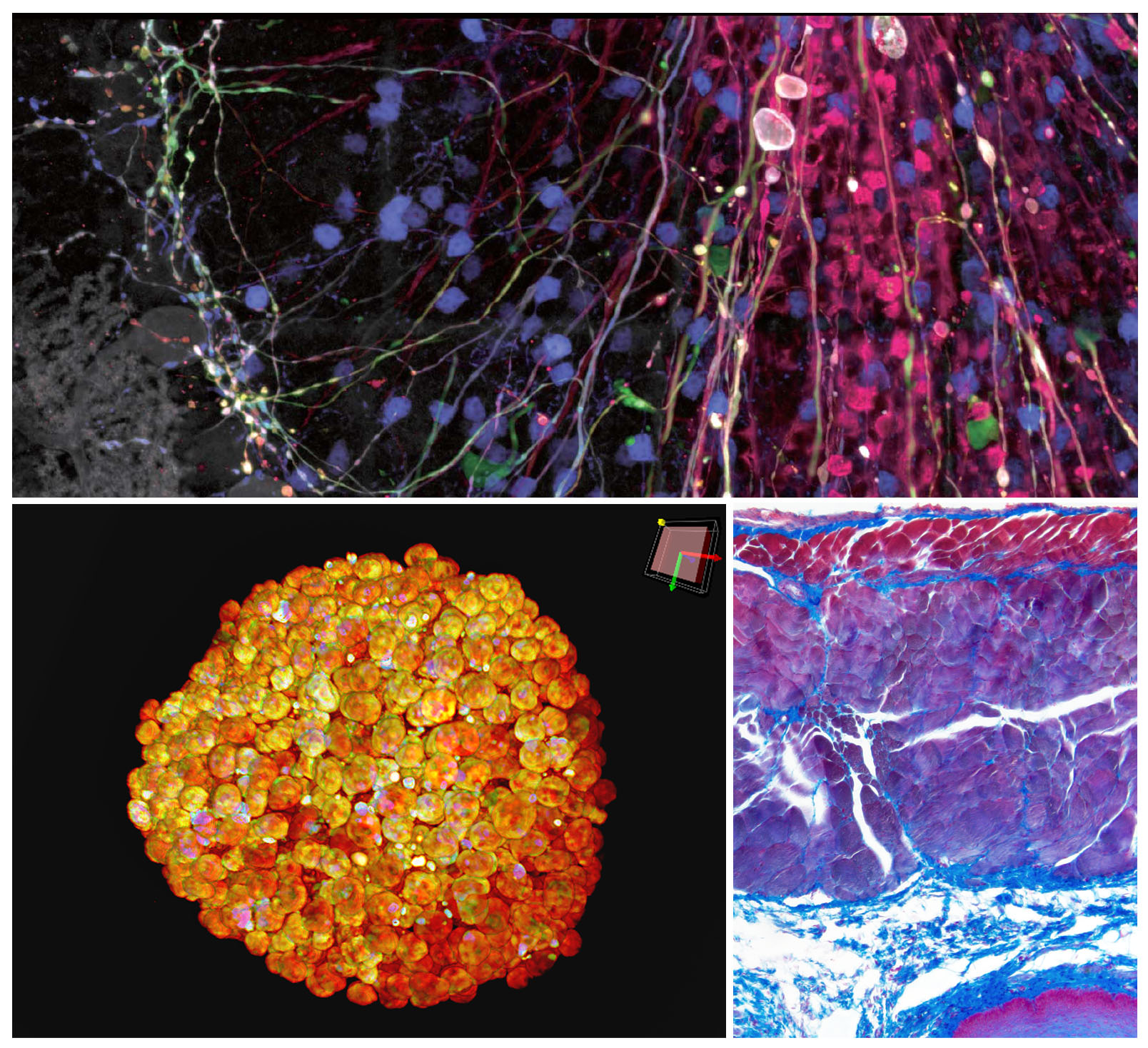 In alto: Immagine di trasfezione di AAV Brainbow di cellule di Purkinje, amplificate con anticorpi; sono visibili soma di cellule di Purkinje dendriti, assoni e alcune macchie non specifiche di cellule granulari acquisite mediante il microscopio FV3000 In basso a sinistra: Sferoide chiarificato di cellule HT-29 colorato con DAPI (nucleare) acquisito attraverso il sistema Spin IXplore Olympus In basso a destra: Azan colorato acquisito attraverso la fotocamera per microscopio digitale DP74 