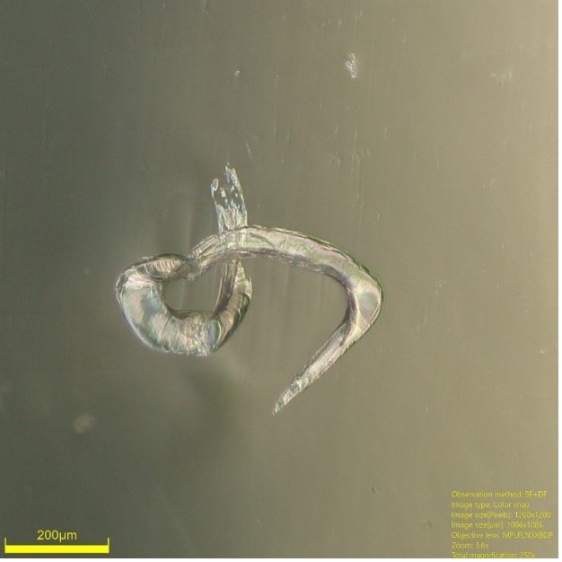 Imagens de partículas estranhas em produtos para bebês aumentadas por microscópio 